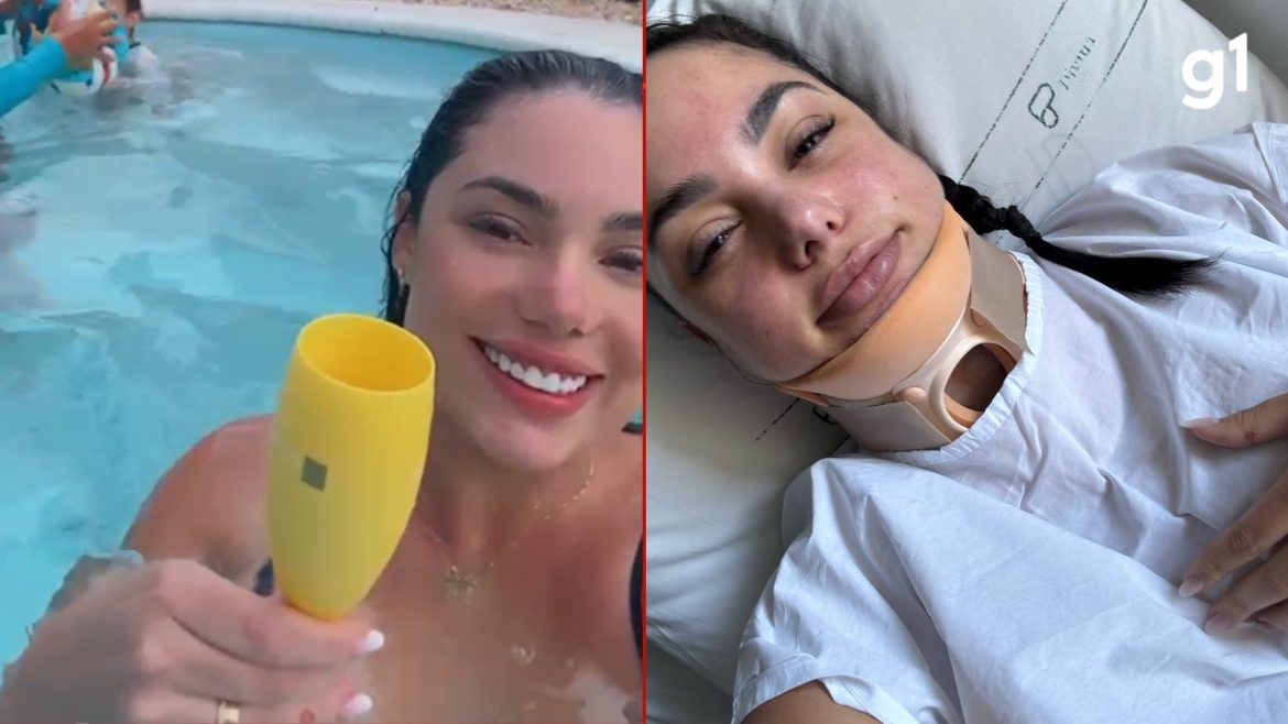 ‘milagre-ter-sobrevivido’:-saiba-como-foi-acidente-de-mulher-que-teve-o-cabelo-preso-em-sugador-de-piscina-e-cervical-quebrada-no-rs