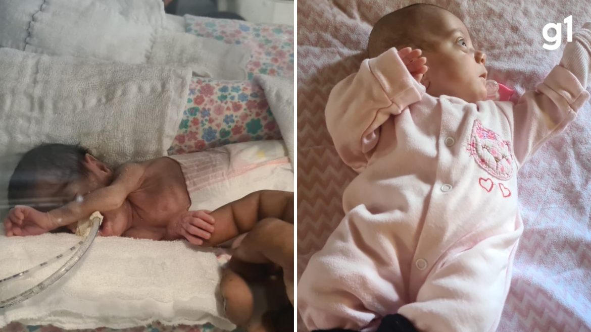 ‘milagre-arco-iris’:-prematura-nascida-com-465-gramas-recebe-alta-apos-quatro-meses-em-hospital-de-porto-alegre
