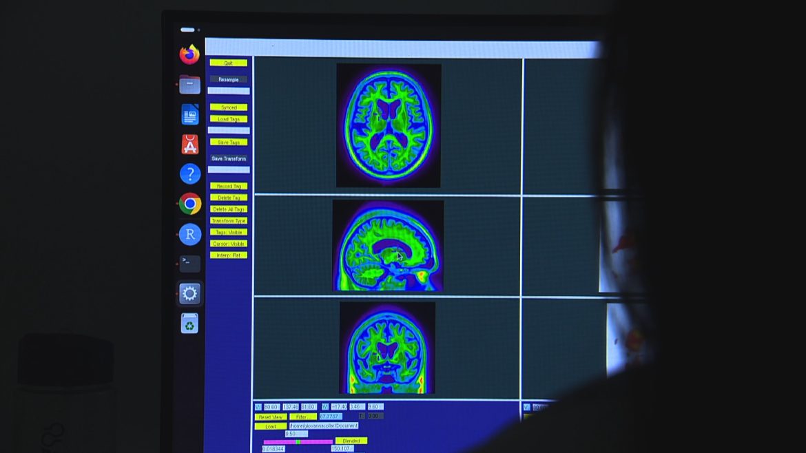 jovem-pesquisadora-do-rs-ganha-premio-internacional-por-estudo-que-revoluciona-diagnostico-de-alzheimer