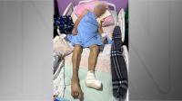 falso-medico-extorque-r$-800-de-vitima-com-cancer-no-df