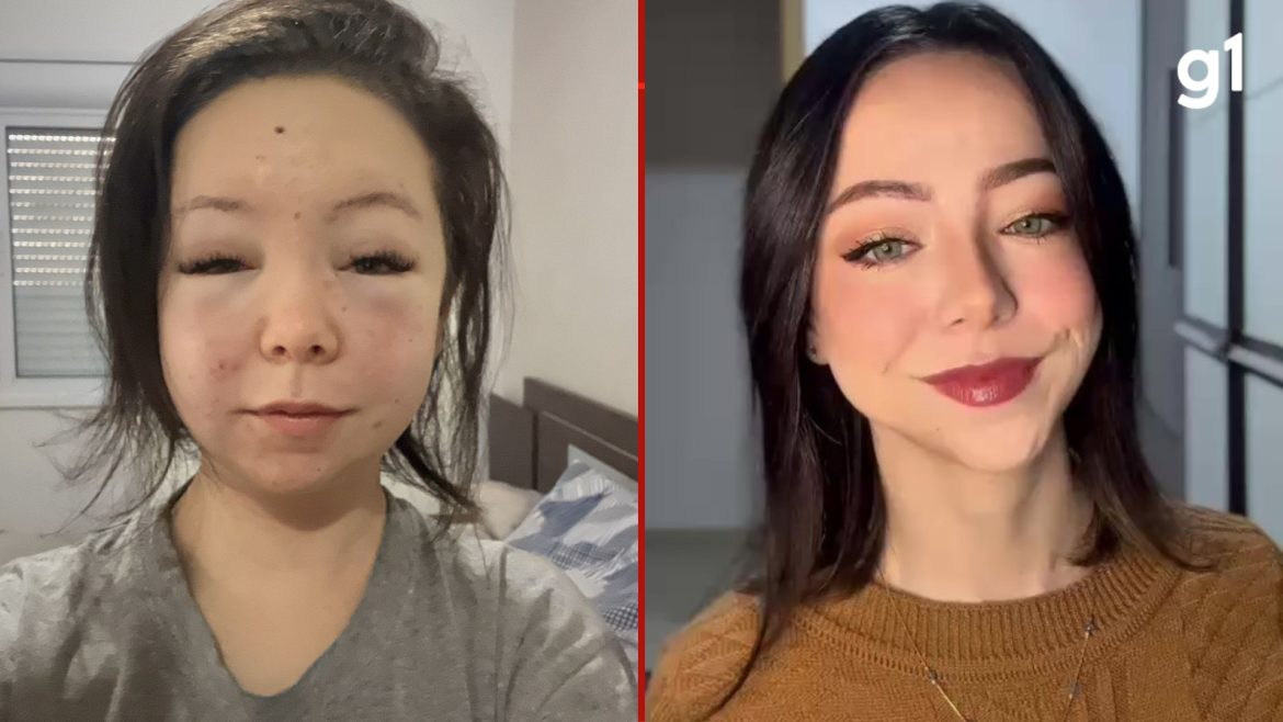 quatro-anos-ate-dar-nome-a-dor:-por-que-tumor-em-jovem-do-rs-levou-tanto-tempo-para-ser-diagnosticado