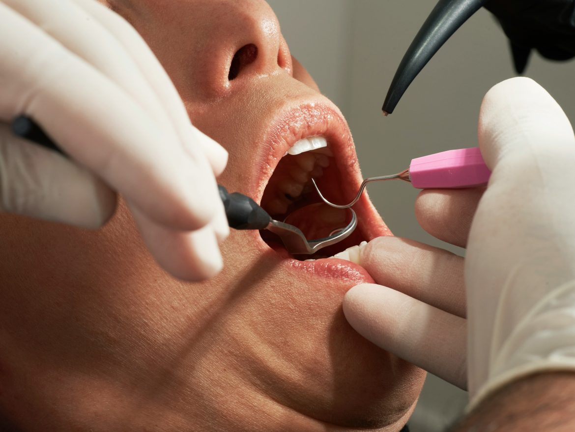 saiba-como-pesquisa-usa-ia-para-identificar-risco-de-cancer-de-boca-com-exames-simples