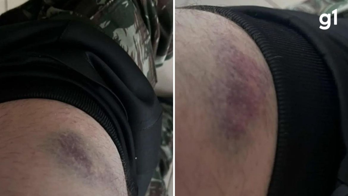 soldado-de-19-anos-relata-agressao-por-colegas-dentro-de-quartel-no-rs