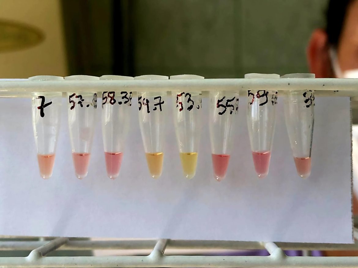 pesquisadora-da-ufsm-cria-teste-rapido-para-diagnostico-de-tuberculose