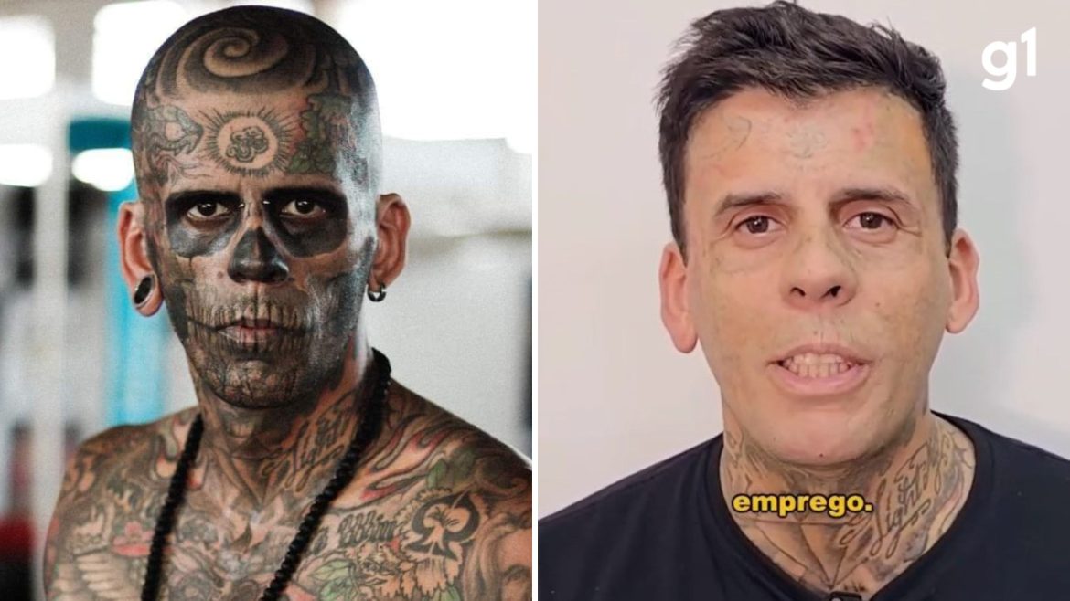 antes-e-depois:-‘mais-tatuado-do-brasil’-surge-irreconhecivel-apos-passar-por-nova-sessao-de-remocao-de-tatuagens-no-rosto