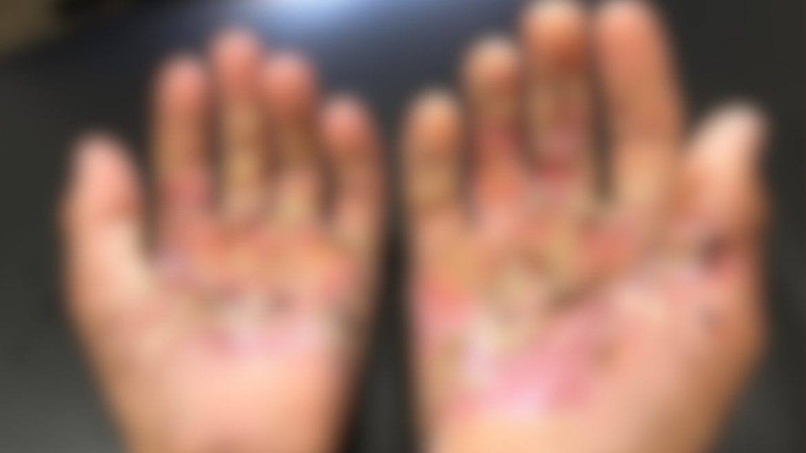 mae-e-presa-suspeita-de-tortura-apos-filho-relatar-ter-sido-queimado-no-fogao-e-ter-sal-jogado-nas-feridas-como-castigo,-diz-policia