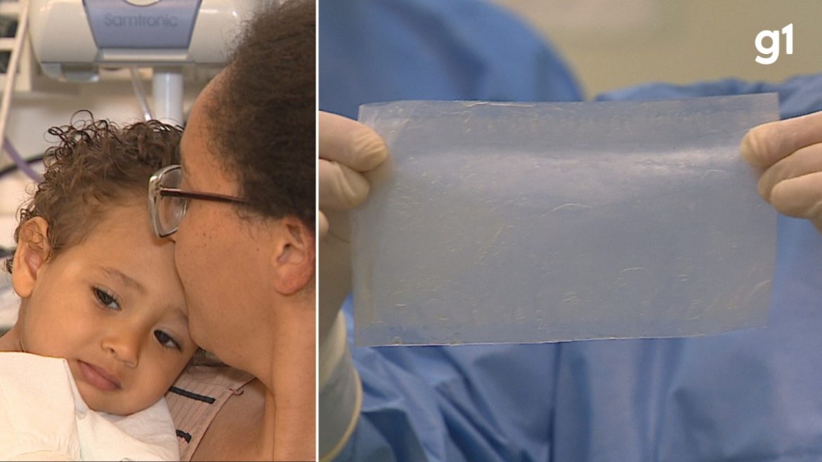 bebe-recebe-transplante-de-membrana-amniotica-para-tratar-queimaduras-no-rs;-saiba-como-funciona-procedimento