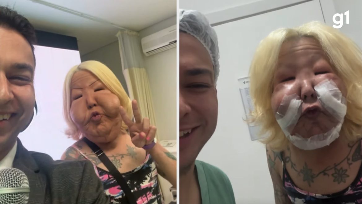 quem-e-‘juju-do-pix’,-influenciadora-do-rs-que-passou-por-cirurgia-reparadora-para-retirar-oleo-mineral-do-rosto