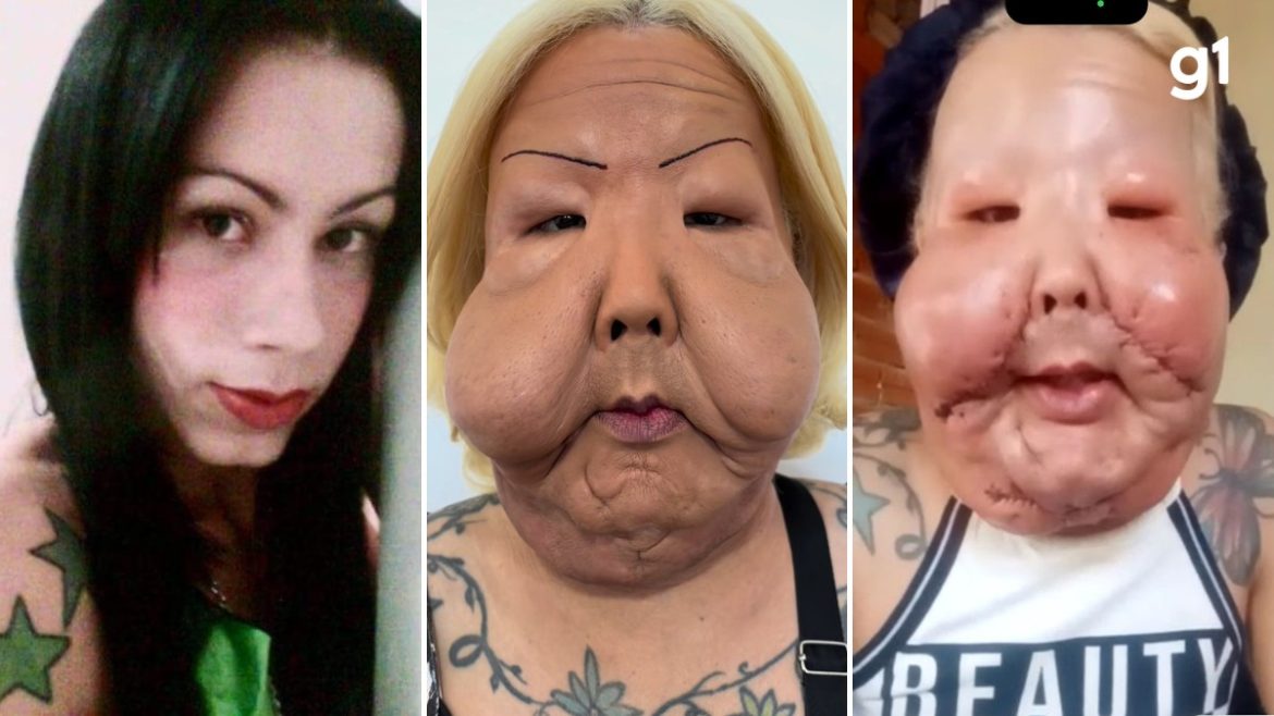 ‘e-facil-voce-rir,-porque-a-dor-nao-ta-em-voce’:-juju-do-pix-fala-pela-primeira-vez-apos-cirurgia-reparadora
