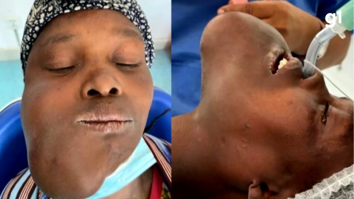 mulher-espera-um-ano-por-cirurgia-e-vira-simbolo-de-missao-humanitaria-de-medicos-do-rs-em-angola