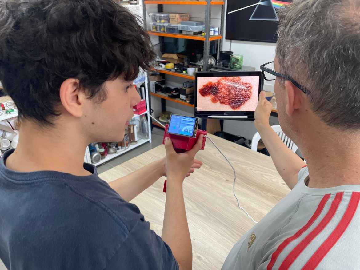 estudantes-do-rs-criam-dispositivo-portatil-com-ia-para-detectar-cancer-de-pele