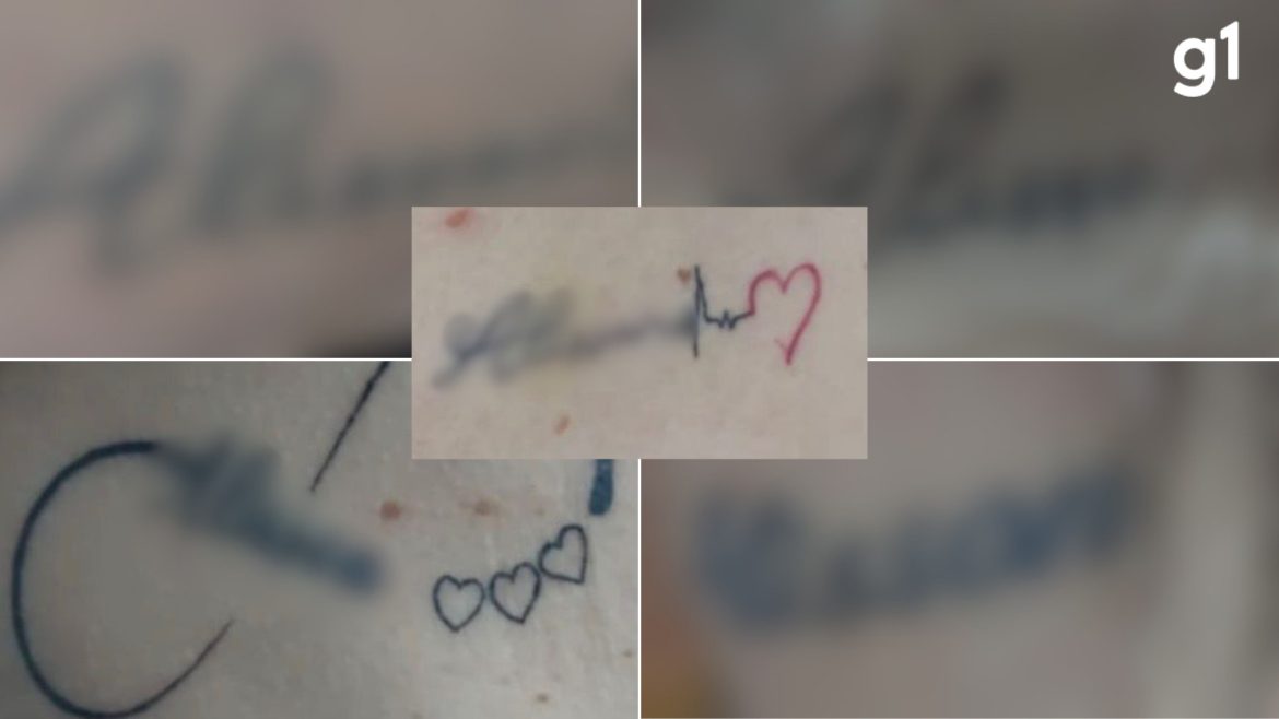 mulher-foi-obrigada-a-fazer-9-tatuagens-com-nome-de-dentista-no-mesmo-dia,-diz-policia