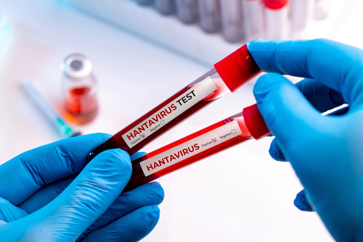hantavirus:-rs-registra-duas-infeccoes-em-areas-rurais-e-um-obito;-casos-nao-tem-relacao-com-navio-da-argentina